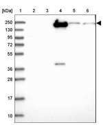 CFHR1 Antibody in Western Blot (WB)