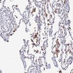 C11orf80 Antibody in Immunohistochemistry (Paraffin) (IHC (P))