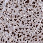 C11orf80 Antibody in Immunohistochemistry (Paraffin) (IHC (P))
