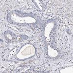 C11orf80 Antibody in Immunohistochemistry (Paraffin) (IHC (P))