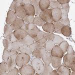 C11orf80 Antibody in Immunohistochemistry (Paraffin) (IHC (P))