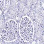 hCG beta Antibody in Immunohistochemistry (Paraffin) (IHC (P))