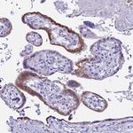 hCG beta Antibody in Immunohistochemistry (Paraffin) (IHC (P))