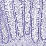 hCG beta Antibody in Immunohistochemistry (Paraffin) (IHC (P))