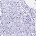 hCG beta Antibody in Immunohistochemistry (Paraffin) (IHC (P))