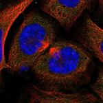 hCG beta Antibody in Immunocytochemistry (ICC/IF)