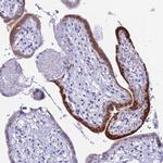 hCG beta Antibody in Immunohistochemistry (IHC)