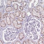 SLC37A4 Antibody in Immunohistochemistry (IHC)