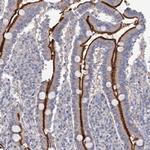 NEK10 Antibody in Immunohistochemistry (Paraffin) (IHC (P))