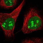 ZCCHC10 Polyclonal Antibody