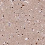 MCF2L2 Polyclonal Antibody