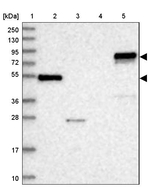 ABLIM1 Antibody in Western Blot (WB)