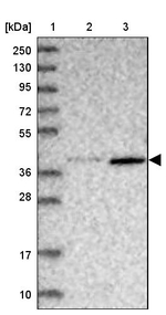 ABLIM1 Antibody in Western Blot (WB)