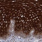 ABLIM1 Polyclonal Antibody