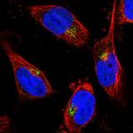 CYB5R2 Polyclonal Antibody