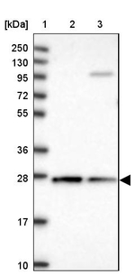CYB5R2 Antibody in Western Blot (WB)