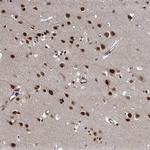 WBP4 Antibody in Immunohistochemistry (Paraffin) (IHC (P))