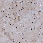 WBP4 Antibody in Immunohistochemistry (Paraffin) (IHC (P))