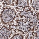 WBP4 Antibody in Immunohistochemistry (Paraffin) (IHC (P))
