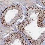WBP4 Antibody in Immunohistochemistry (Paraffin) (IHC (P))