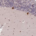 N4BP2L1 Polyclonal Antibody