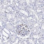 DEF6 Antibody in Immunohistochemistry (IHC)