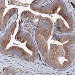 BRWD2 Antibody in Immunohistochemistry (IHC)