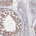 RNF44 Antibody in Immunohistochemistry (Paraffin) (IHC (P))