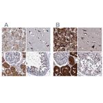 CLPB Antibody in Immunohistochemistry (IHC)