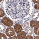 CLPB Antibody in Immunohistochemistry (IHC)
