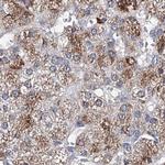CLPB Antibody in Immunohistochemistry (IHC)