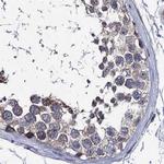 CLPB Antibody in Immunohistochemistry (IHC)