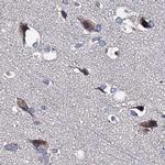 CLPB Antibody in Immunohistochemistry (IHC)