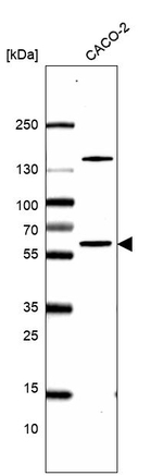 CLPB Antibody in Western Blot (WB)