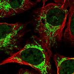 DYNC2H1 Polyclonal Antibody