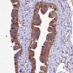 DYNC2H1 Antibody in Immunohistochemistry (Paraffin) (IHC (P))