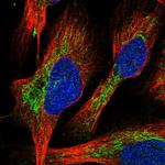 DYNC2H1 Polyclonal Antibody