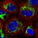 MMAB Polyclonal Antibody