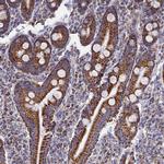 MMAB Antibody in Immunohistochemistry (Paraffin) (IHC (P))
