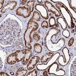 MMAB Antibody in Immunohistochemistry (Paraffin) (IHC (P))
