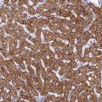 MMAB Antibody in Immunohistochemistry (Paraffin) (IHC (P))