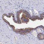 MMAB Antibody in Immunohistochemistry (Paraffin) (IHC (P))
