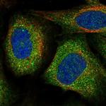 VPS11 Polyclonal Antibody