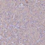 METTL20 Polyclonal Antibody