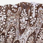 Importin 4 Polyclonal Antibody