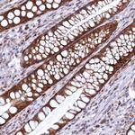 CHCHD1 Antibody in Immunohistochemistry (Paraffin) (IHC (P))