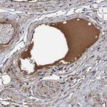 C14orf80 Polyclonal Antibody