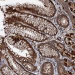 C14orf80 Antibody in Immunohistochemistry (Paraffin) (IHC (P))
