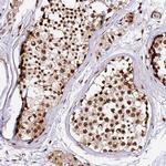 MCRS1 Antibody in Immunohistochemistry (Paraffin) (IHC (P))