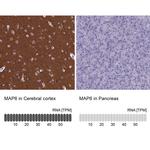 MAP6 Antibody in Immunohistochemistry (IHC)